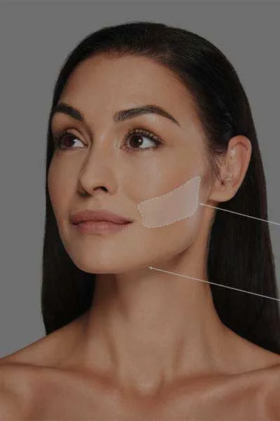 Trusted Buccal Fat Removal Service in Quezon City