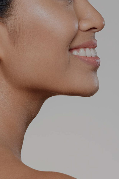 Trusted Buccal Fat Pad Removal surgery in Philippines